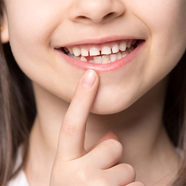 歯並びと口腔育成との関係性